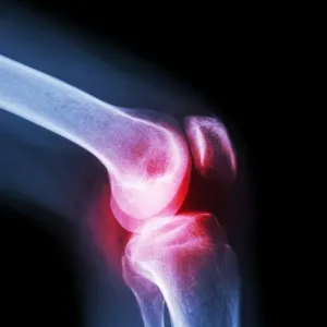 Elastic Knee Cap for Support & Pain Relief