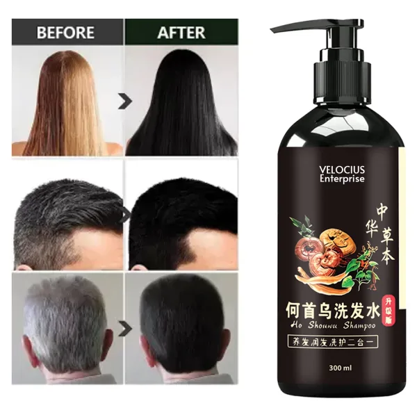 Shon hair shampoo for gorgeous tresses and ultimate hair transformation